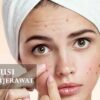 Tips Memilih Produk Pembersih Wajah Untuk Kulit Berjerawat