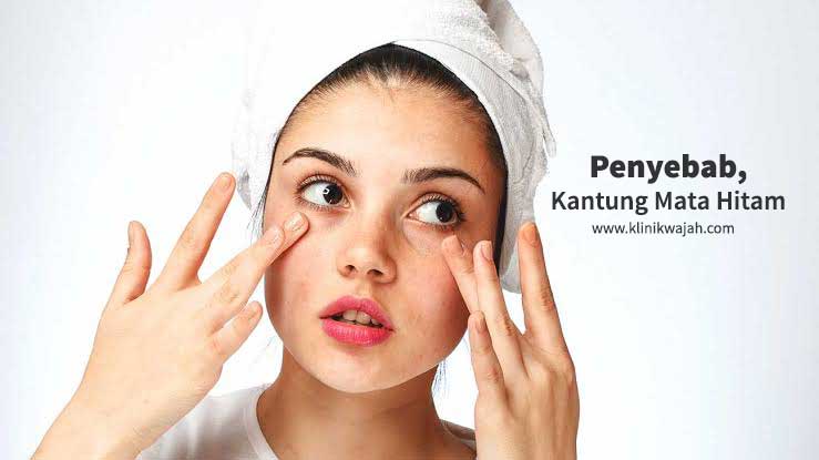 concealer-kantung-mata-hitam