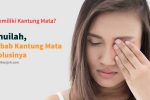 penyebab-kantung-mata