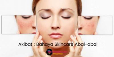 bahaya-skincare-abal-abal