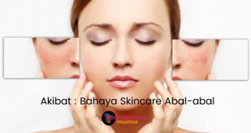 bahaya-skincare-abal-abal