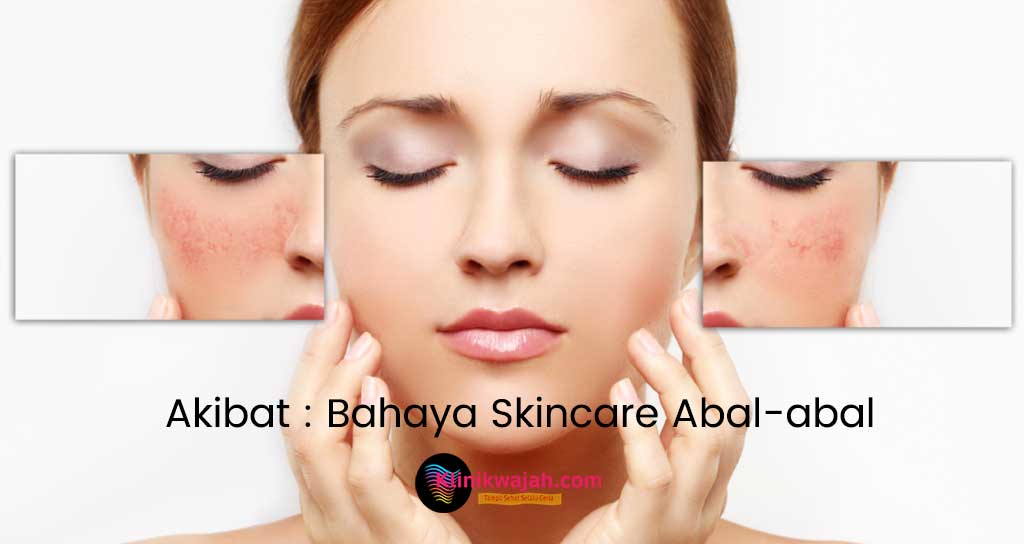 bahaya-skincare-abal-abal