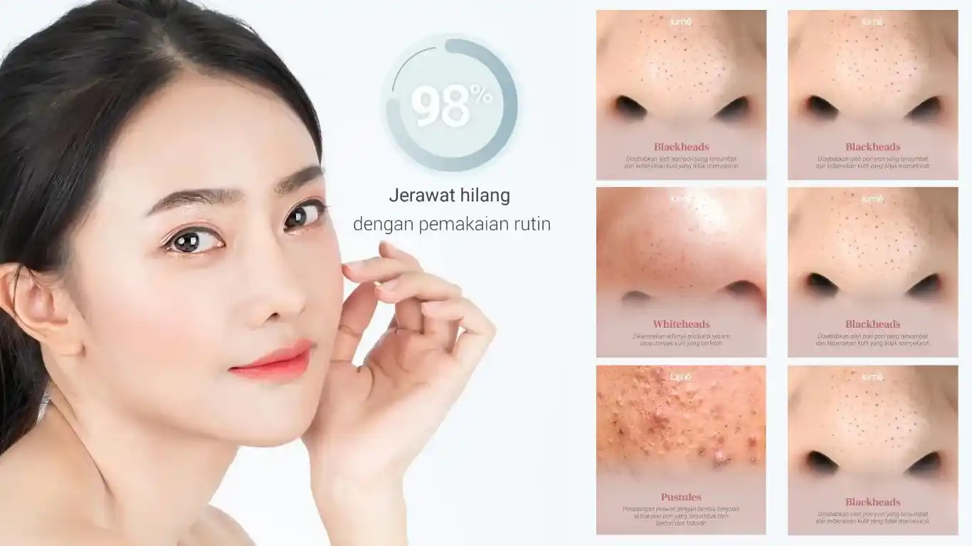 manfaat Acne Spot Treatment