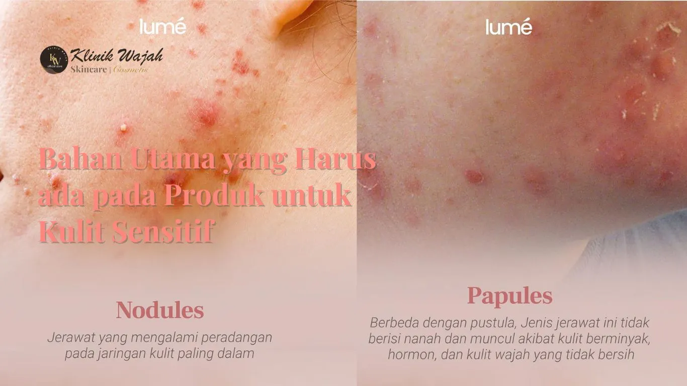 Produk untuk kulit sensitif